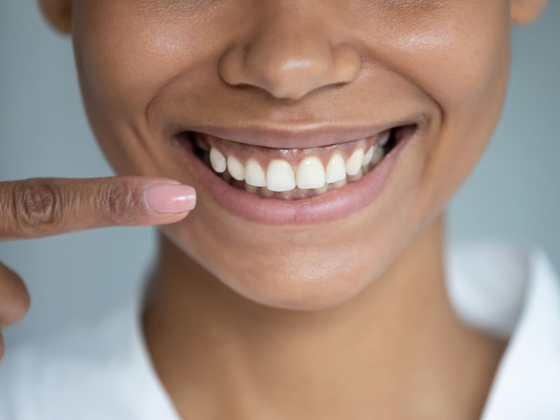 Patient with Healthy Gums